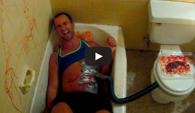 La broma del transplante de órganos que te dejará sin palabras