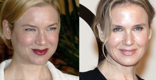 La irreconocible nueva cara de Renée Zellweger, ¿una de las peores cirugías de Hollywood?