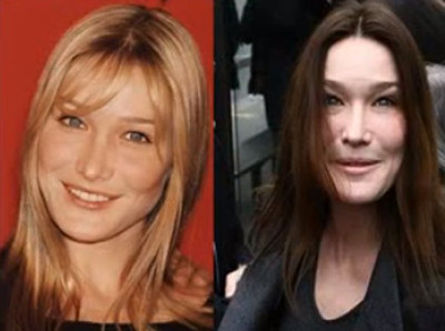 La irreconocible nueva cara de Renée Zellweger, ¿una de las peores cirugías de Hollywood?