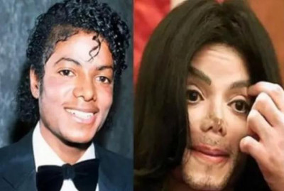 La irreconocible nueva cara de Renée Zellweger, ¿una de las peores cirugías de Hollywood?