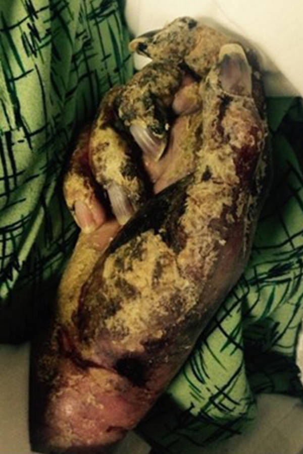 El brutal caso de la modelo devorada viva por garrapatas