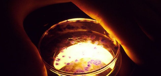 Rusia advierte de bacterias espaciales mutantes mortales