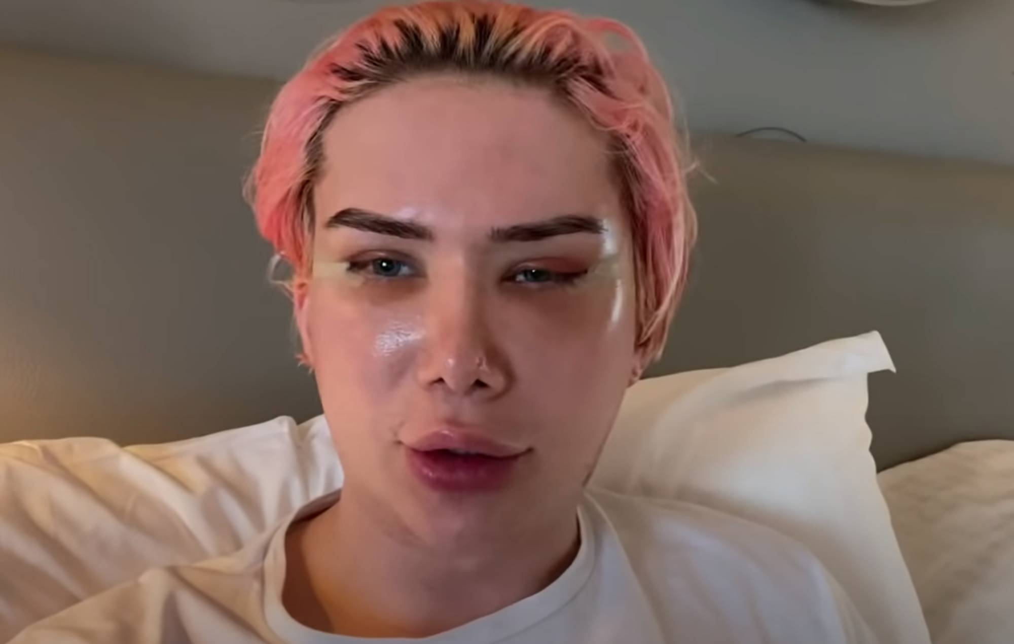 Un influencer británico se identifica como coreano y se opera para parecerse a Jimin de BTS