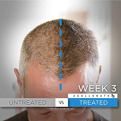 Xcellerate35 Ritual - voluminizador Champú - promueve más cabello más grueso más largo más completo y más rápido crecimiento - anti-caída para Hombres y Mujeres - 8 fl oz