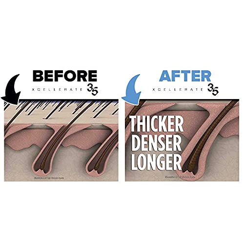 Xcellerate35 Ritual - voluminizador Champú - promueve más cabello más grueso más largo más completo y más rápido crecimiento - anti-caída para Hombres y Mujeres - 8 fl oz