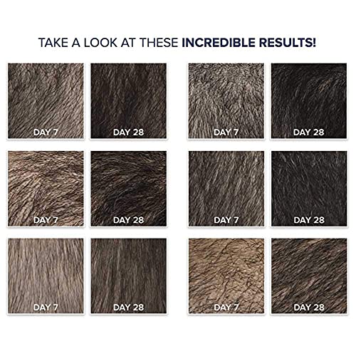 Xcellerate35 Ritual - voluminizador Champú - promueve más cabello más grueso más largo más completo y más rápido crecimiento - anti-caída para Hombres y Mujeres - 8 fl oz