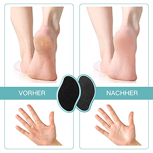 AOT 2 Piezas Lima Pies Vidrio Nano Callos Quita Durezas para Pies Eliminar de Callosidades y Muertas Piel Profesional Aparato de Pedicura Cuidado de Pies