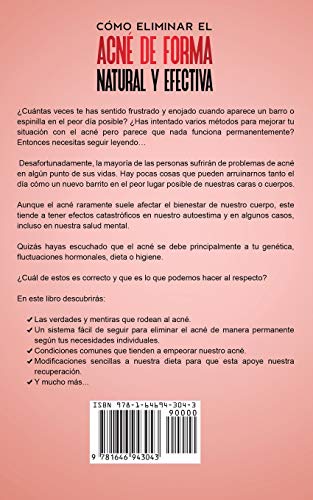 Cómo Eliminar el Acné de Forma Natural y Efectiva: Remedios altamente efectivos para eliminar granos, espinillas, puntos negros y cicatrices para siempre