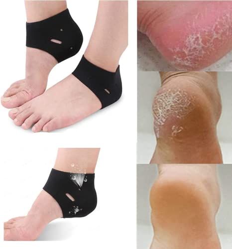 MTDBAOD Moisturising Heel Socks,Vented Moisturizing Heel Gel Socks,for Repairing and Softening Dry Cracked Feet Skins, High-Absorption SPA Socks - 2 Pairs