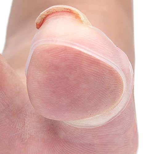 NXM Herramienta De Corrección De Uñas Encarnadas Hebilla Corrección La Uña Encarnada Y Elevador Silicona 2 Juegospara Aliviar Dolor Paroniquia Corrector Paroniquia Corrector Cuidado