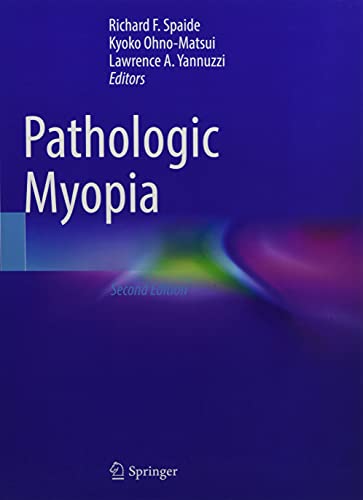 Pathologic Myopia