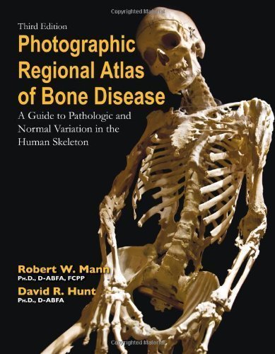 Photographic Regional Atlas of Bone Disease: A Guide to Pathologic and Normal Variation in the Human Skeleton by Robert W Mann Dr(2013-02-01)