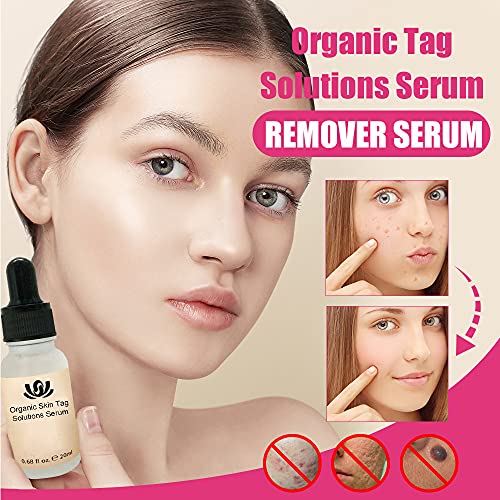 WYBF 2/3pcs Organic Tags Solutions Serum,Organic Skin Spot Purifying serum,Mole Remover Cream, Dark Spot Corrector Brightening Serum, Repair Cream Oil Fix Black Spot 20ml (3pcs)
