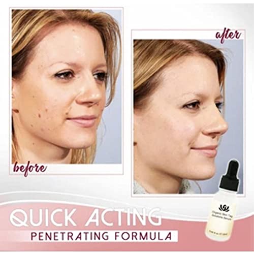 WYBF 2/3pcs Organic Tags Solutions Serum,Organic Skin Spot Purifying serum,Mole Remover Cream, Dark Spot Corrector Brightening Serum, Repair Cream Oil Fix Black Spot 20ml (3pcs)