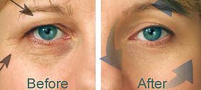 Belleza Ion Pro viajero Sistema galvánico cara, los ojos, Sistema de Estiramiento de Cuello