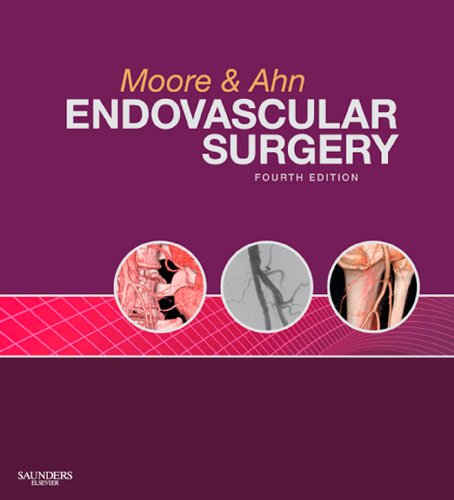 Endovascular Surgery E-Book: Expert Consult - Online and Print, with Video (English Edition)