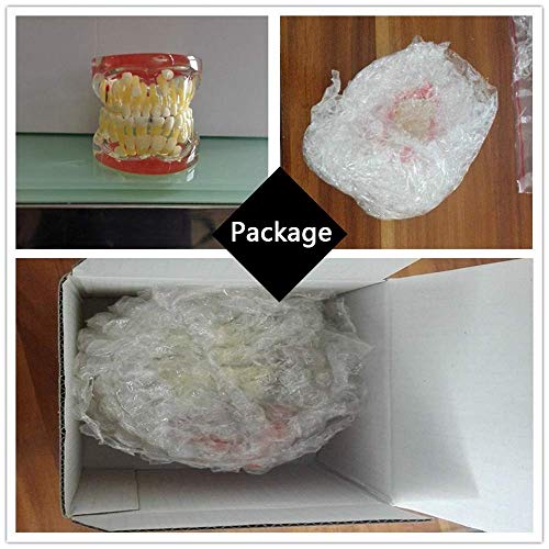 HYCy Anatomy Teeth Model - Pathologic Deciduous Teeth Model - Transparent Dental Teeth Model - Show The Deciduous Teeth,Caries and Apical Cyst Pathological Structure