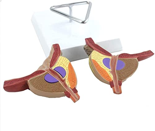 IVQAPP Prostate Anatomical Model Zoom 2X Male Prostate Model Detachable 4 Parts Human Organ Anatomical Model for Study Dislay Teaching Model