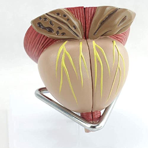 IVQAPP Prostate Anatomical Model Zoom 2X Male Prostate Model Detachable 4 Parts Human Organ Anatomical Model for Study Dislay Teaching Model