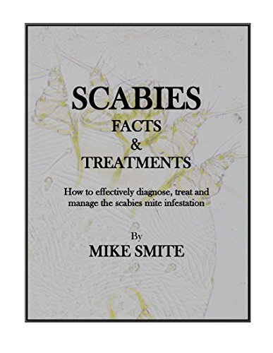 Scabies Facts & Treatments (English Edition)