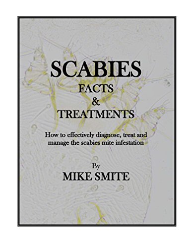 Scabies Facts & Treatments (English Edition)