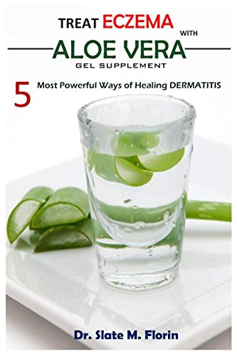 Treat Eczema With Aloe Vera Gel Supplement: 5 most powerful ways of Healing Dermatitis