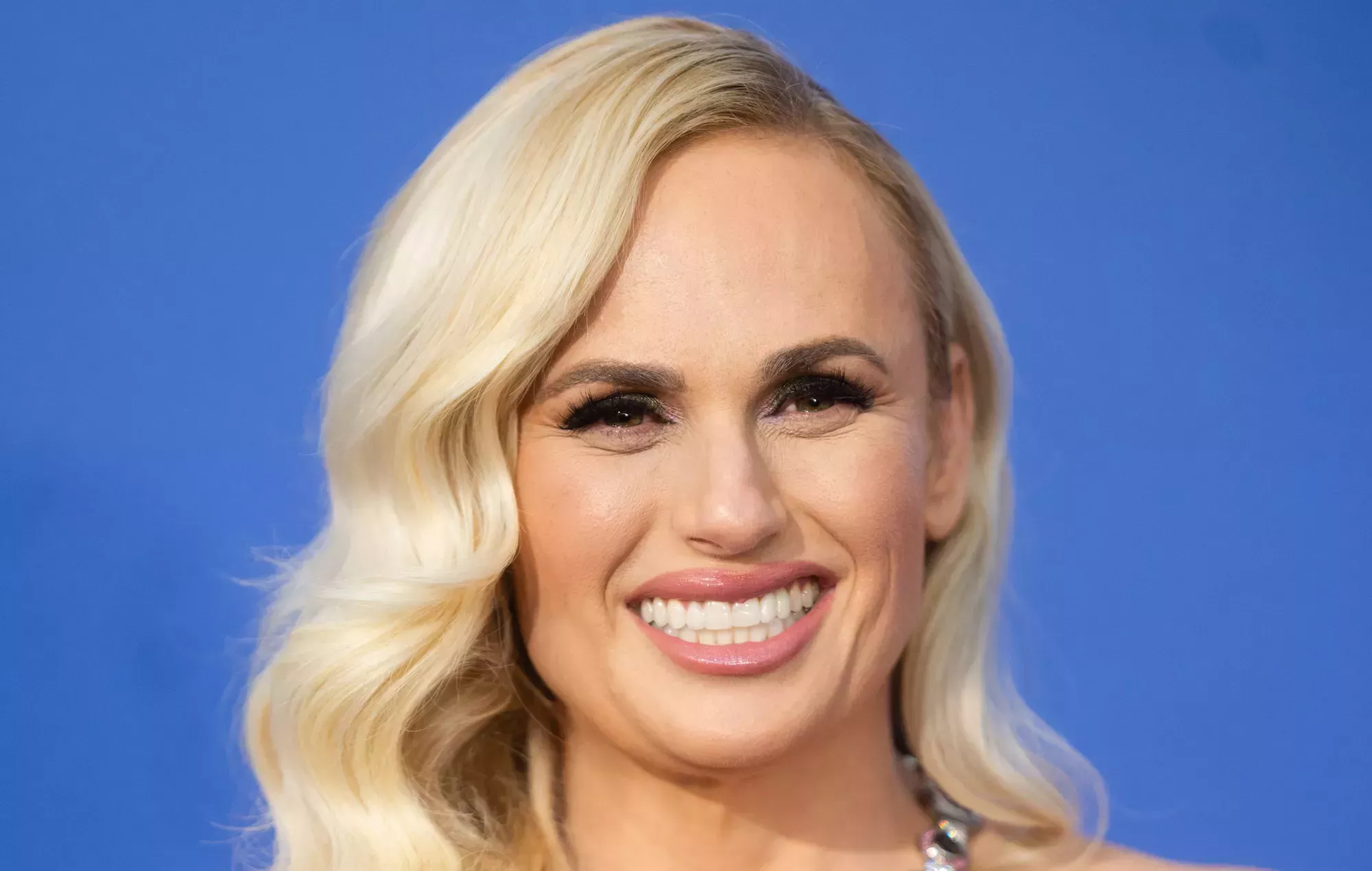 Rebel Wilson necesitó puntos de sutura en el hospital tras un 